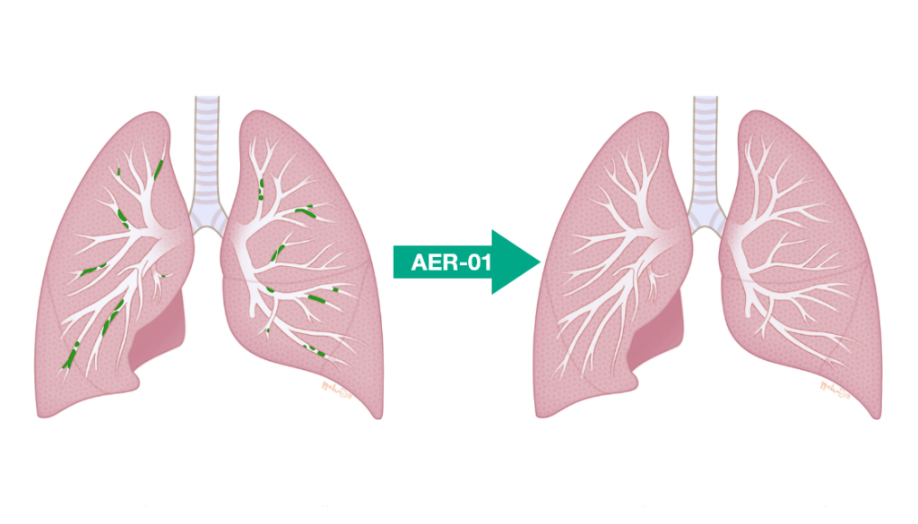 Lung diagram