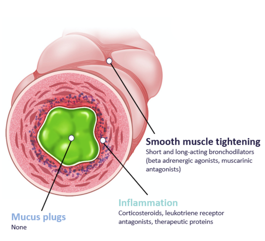 Mucus Plug diagram